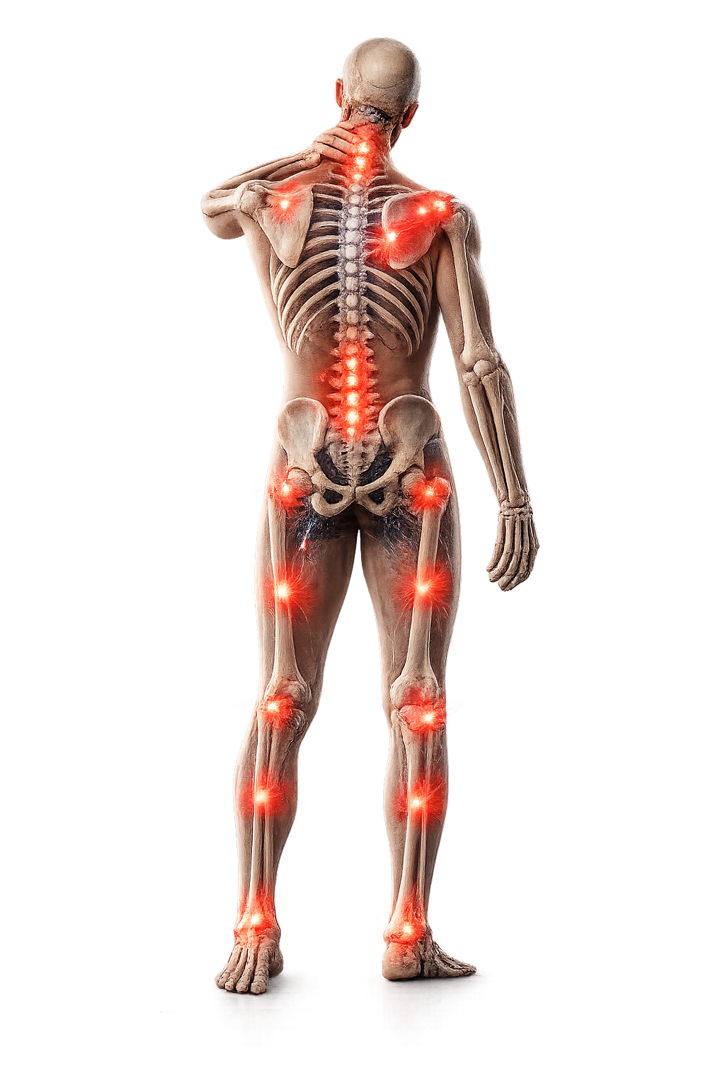 Fibromiyalji Ağrı Noktaları Haritası - 18 Tender Point